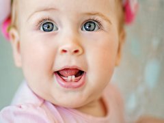 बच्चों के दूध के दांत निकलते समय होती है कई दिक्कते ,करें ये उपाय