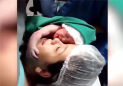मां के गर्भ से निकलते ही चेहरे से चिपक गया बच्चा,  देखें वीडियो