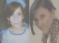 पैदा होते ही बूढ़ी हो गई बच्ची! मां के गर्भ में ही आ गया था बुढ़ापा