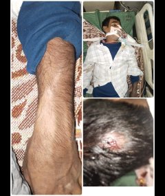 चौपारण में दर्दनाक सड़क हादसा : बारात में घुसी ओमिनी, एक युवक की मौत, कई घायल चतरा मोड़ के पास मचा कोहराम, पुलिस ने वाहन जब्त कर जांच शुरू की