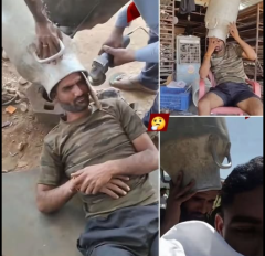 गर्मी से बचने का देसी जुगाड़ पड़ा भारी! युवक के सिर में फंसा दूध का कैन