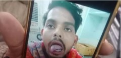 गाजियाबाद में पत्नी ने पति की जीभ काट दी