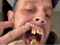 शख्स के दांत देखते ही भाग जाती थी लड़कियां, कहती थीं छी-छी, आज डेट करने के लिए करती है पीछा!