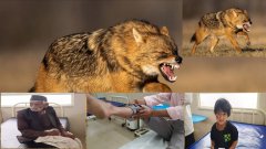 जंगली सियार बना आदमखोर,गांव में दहशत एक ही दिन में 9 ग्रामीणों पर हमला,दो मासूम बच्चे,महिलाएं व बुजुर्ग घायल