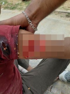 गांव में पागल बंदर का आतंक, अब तक 7-8 लोगों को किया घायल