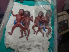 एक साथ गूंजी चार बच्चों की किलकारी, महिला ने 3 बेटों और 1 बेटी को दिया जन्म